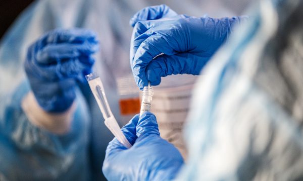 Një variant i ri i Covid do të qarkullojë gjatë verës, ja simptomat