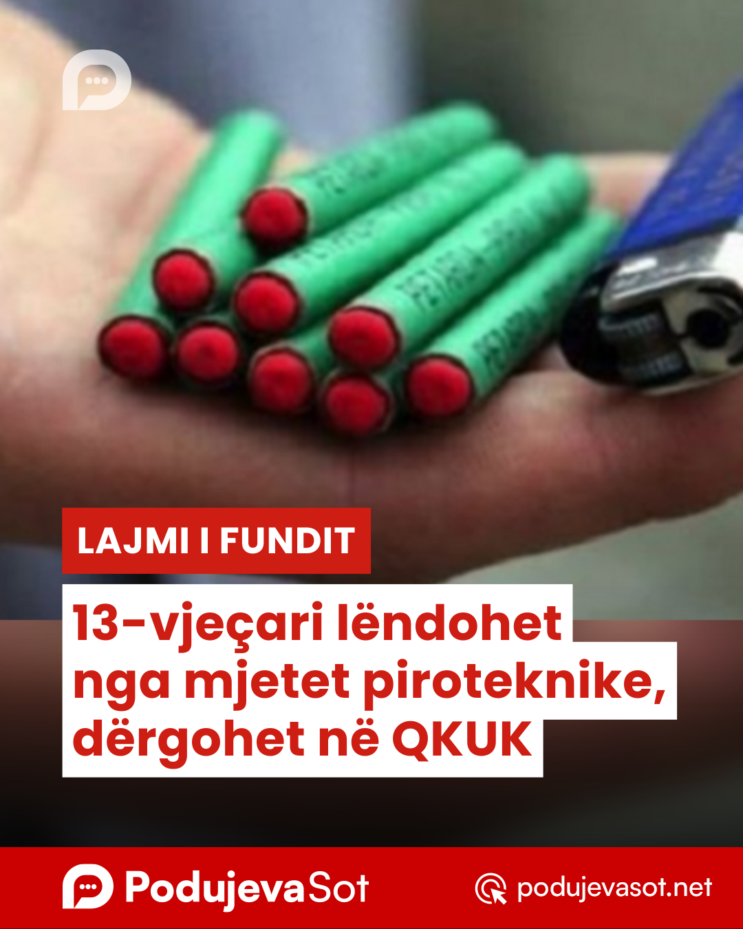 13-vjeçari lëndohet nga mjetet piroteknike, dërgohet në QKUK